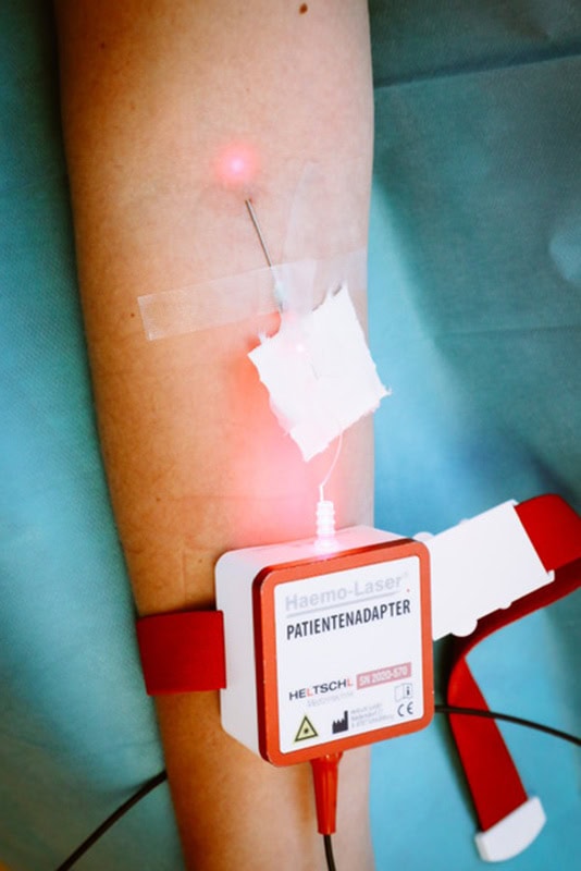 Innovative Lasertherapie beim Hausarzt in München